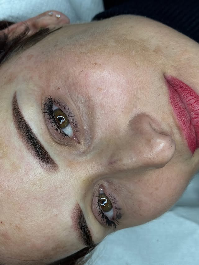 Corrección y neutralización de cejas tatuadas antiguas