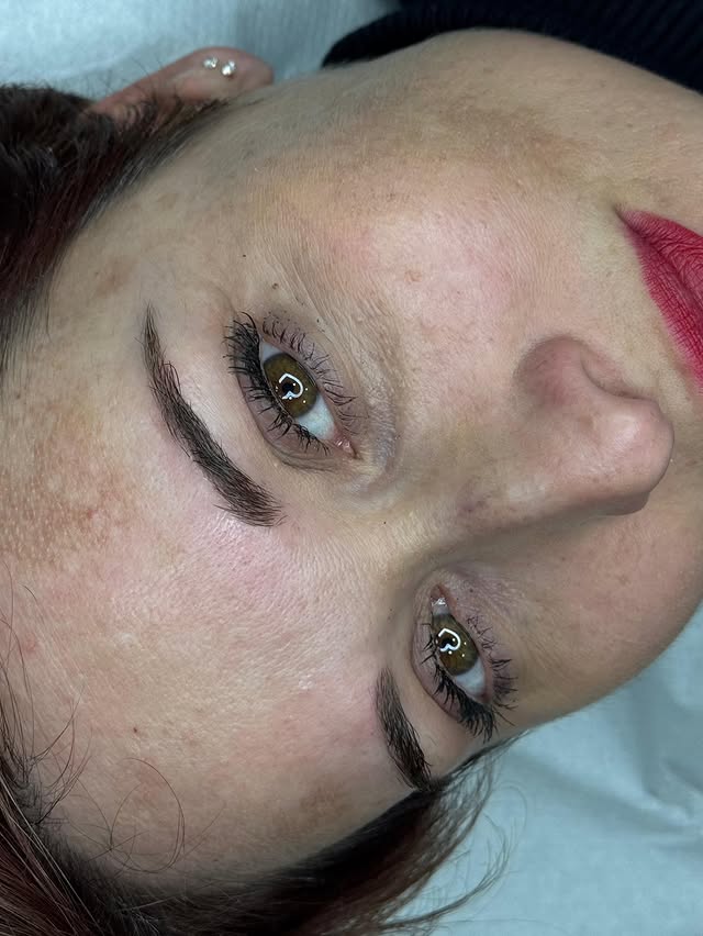 Resultado antes y después de tratamiento de cejas 3